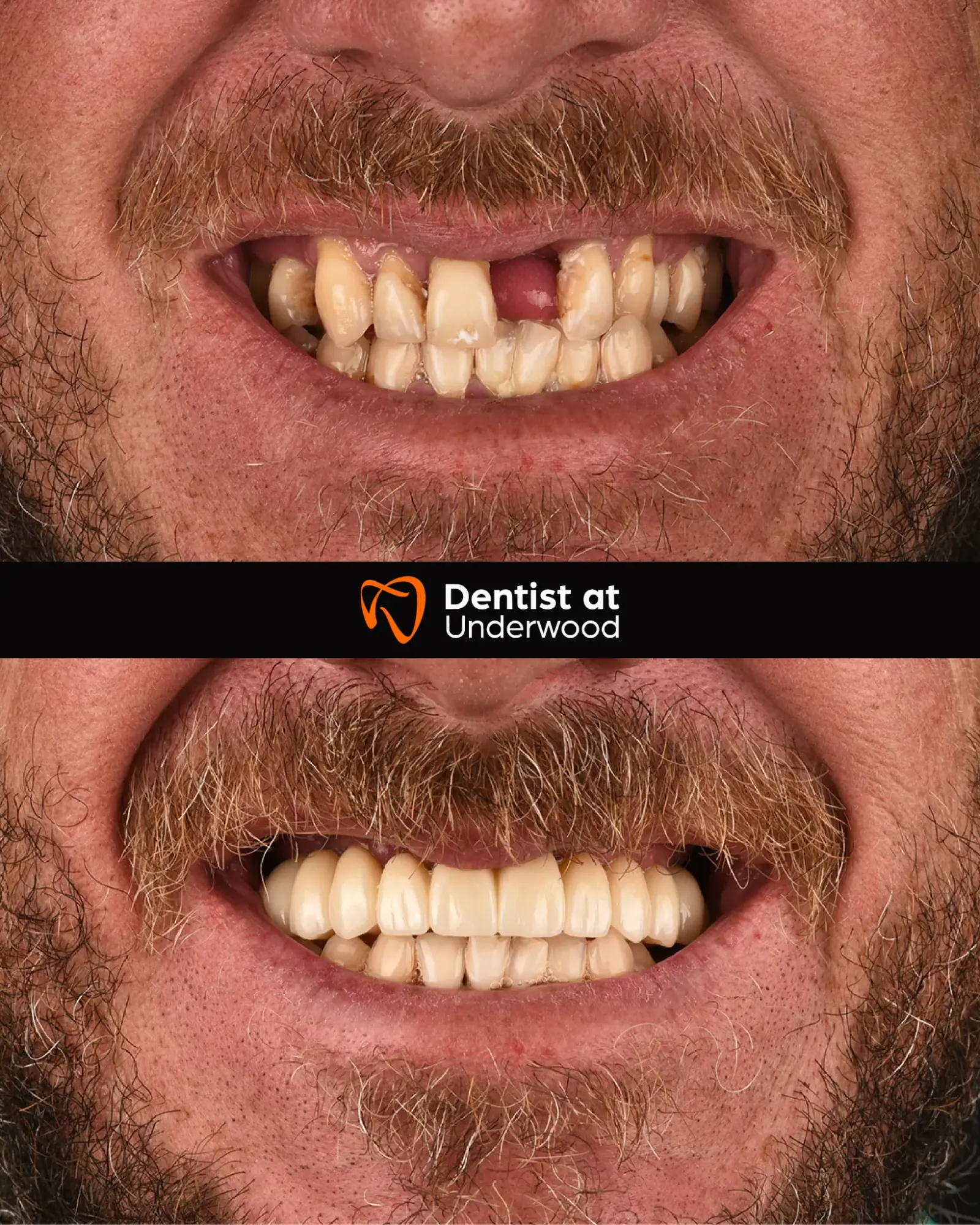 Dental treatment case 4