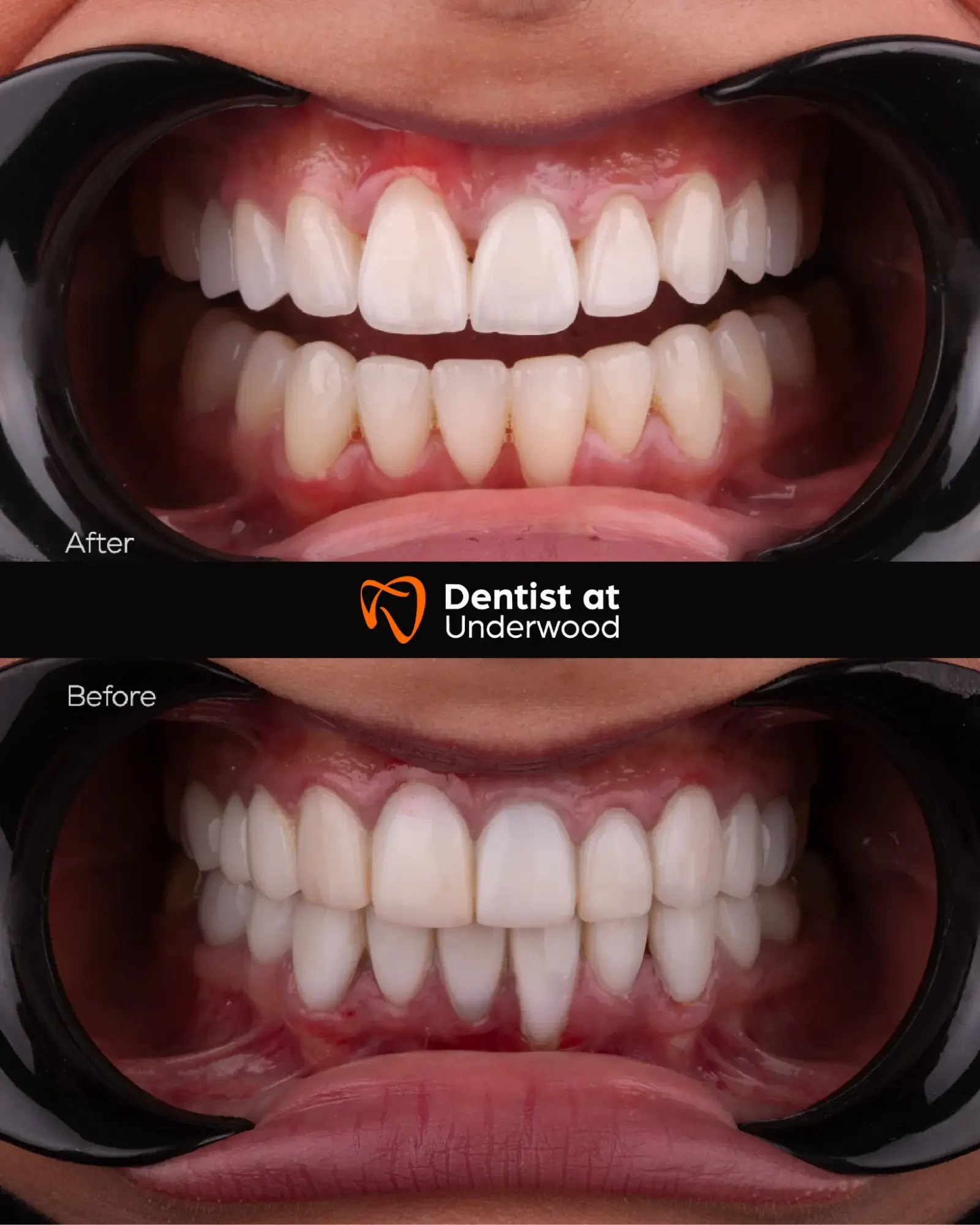 Dental treatment case 8